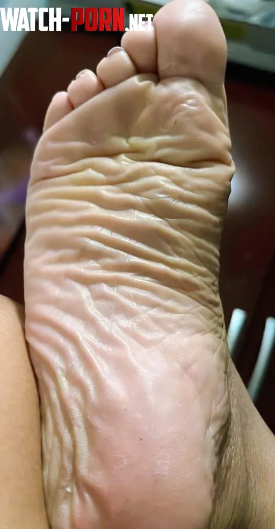 It's soles Sunday. I give you The wrinkliest latina feet. Count em by arboldebolas