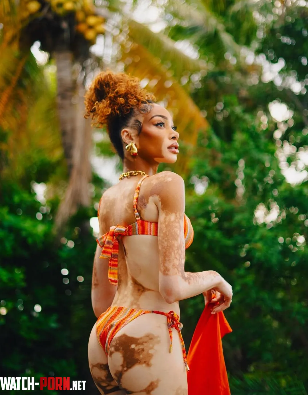 Winnie Harlow by onehornymofo1