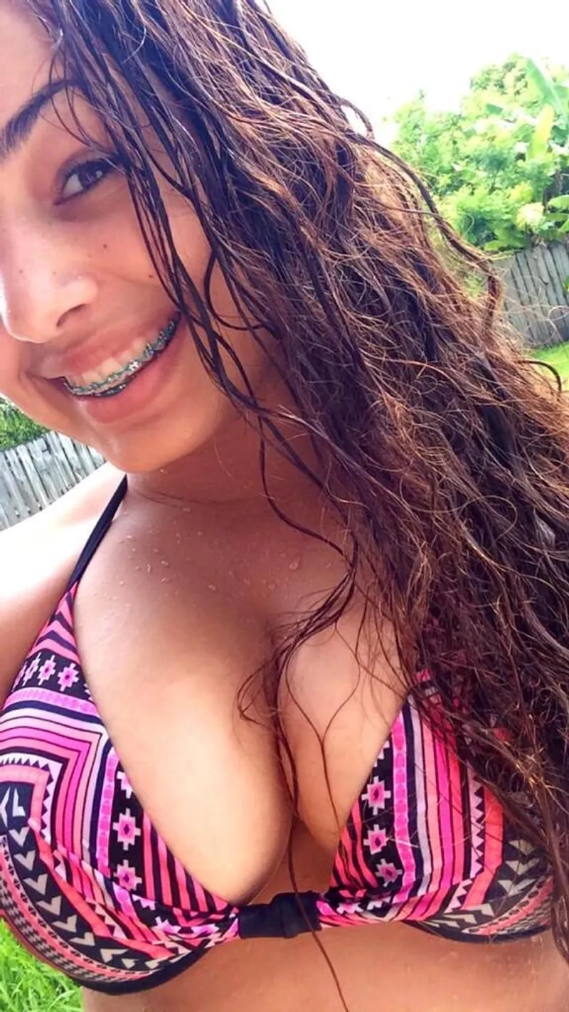 Thumbnail Exploring 'Braces...' with OrlandoHeat3 | bigtitsinbikinis