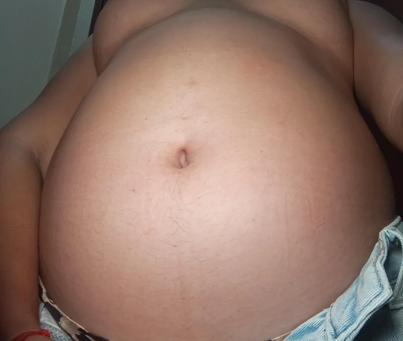 Thumbnail Soft and Squishy Tummy Transformation Before and After | Glass_Ganache_6096