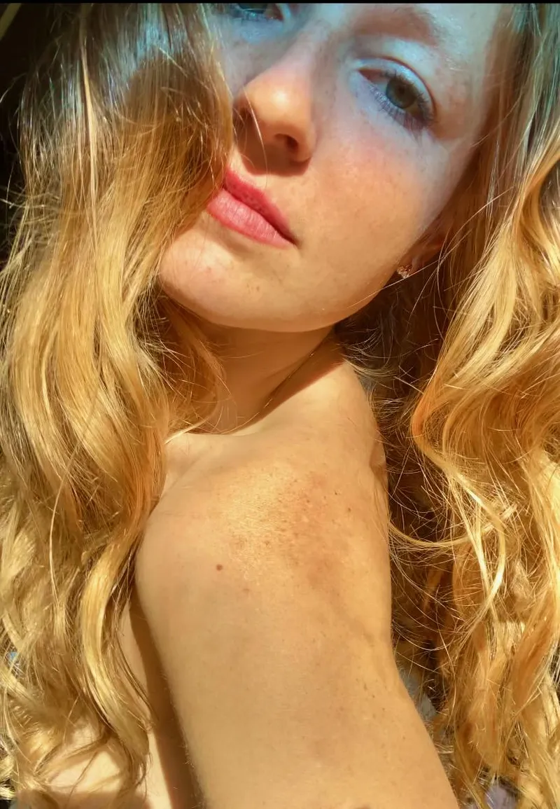Thumbnail more freckles 0r less by freedom_fruit
