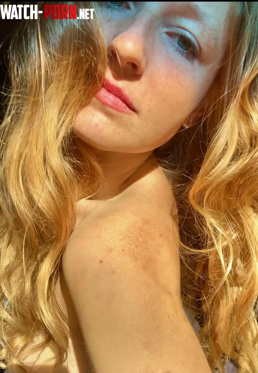 more freckles 0r less by freedom_fruit