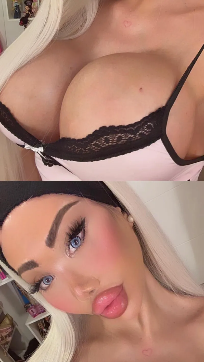Thumbnail Luxury_Plastic_Doll on Bimbofication of Lips and Fetish