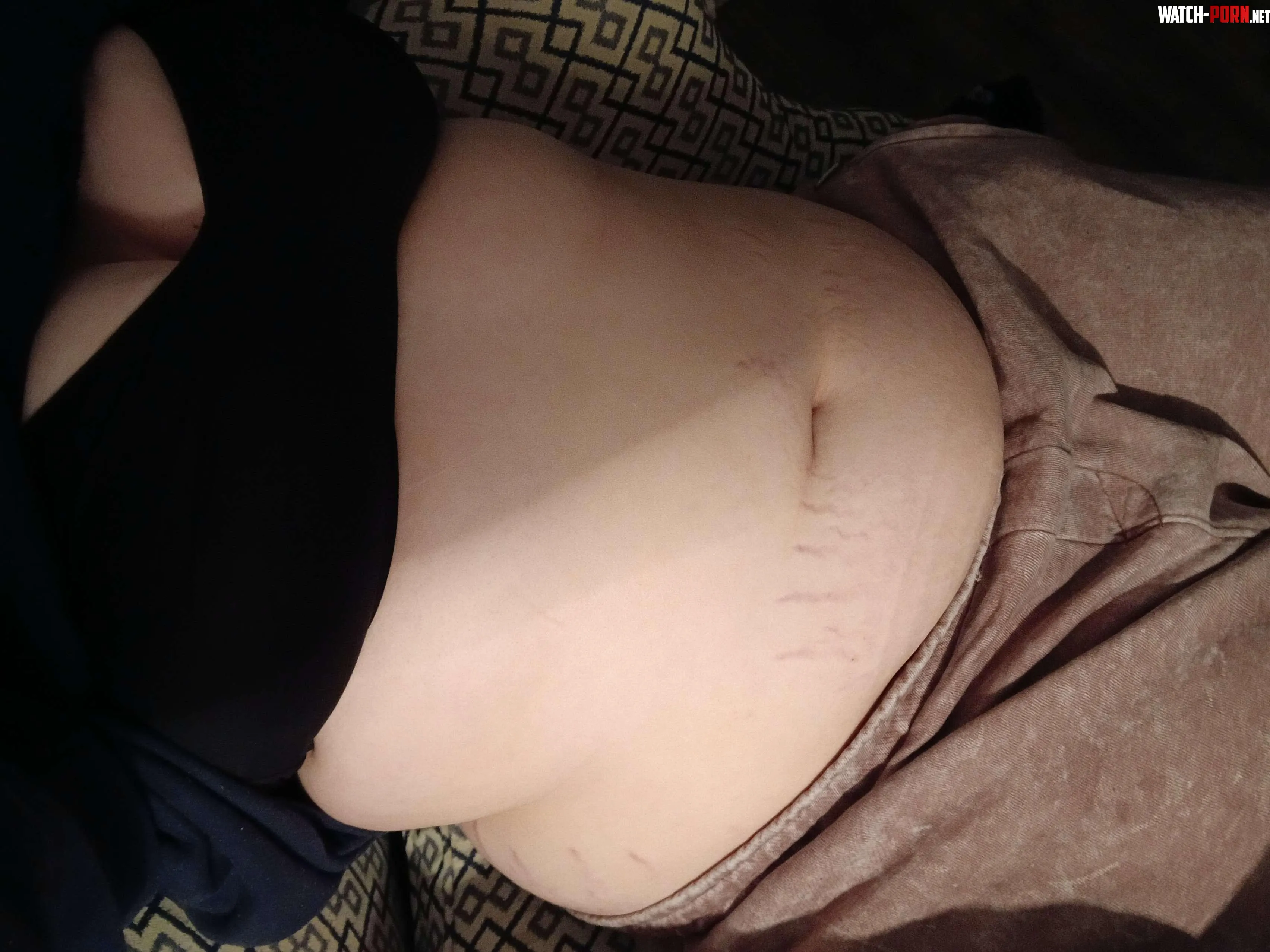 Belly could use tons of love by Gold_Poetry3308