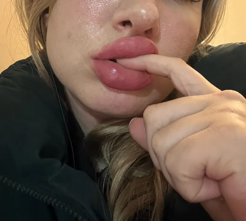 Thumbnail Celebrating Pout: Exploring Luscious Lips | glazedskin-