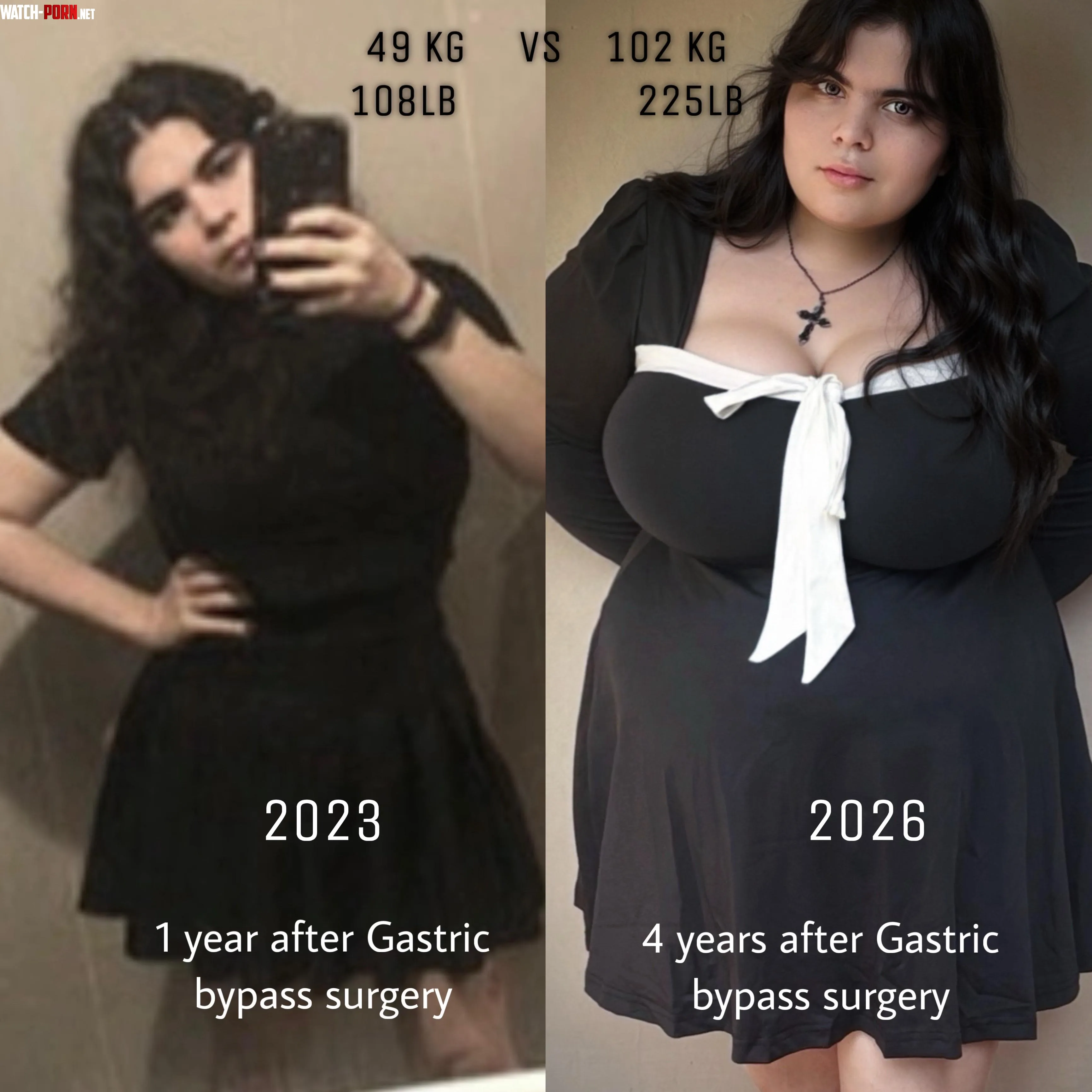 Oops! I did it again! My belly is such a bratty, gained almost all of my weight again after GBS by go_thicc