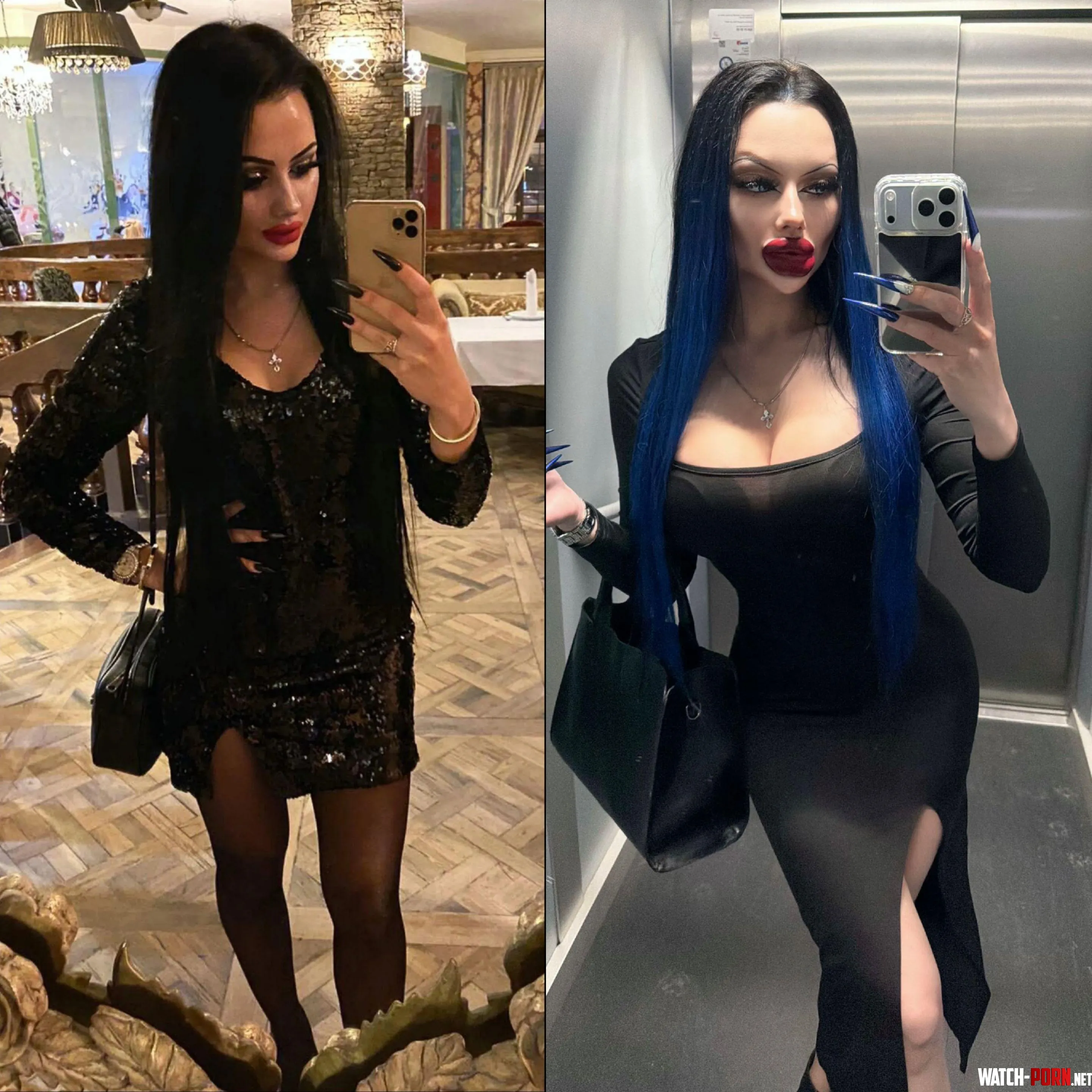 Black dress update, 0cc and 0 filler vs 625cc and a mountain of filler <3 by PurePerfectDoll