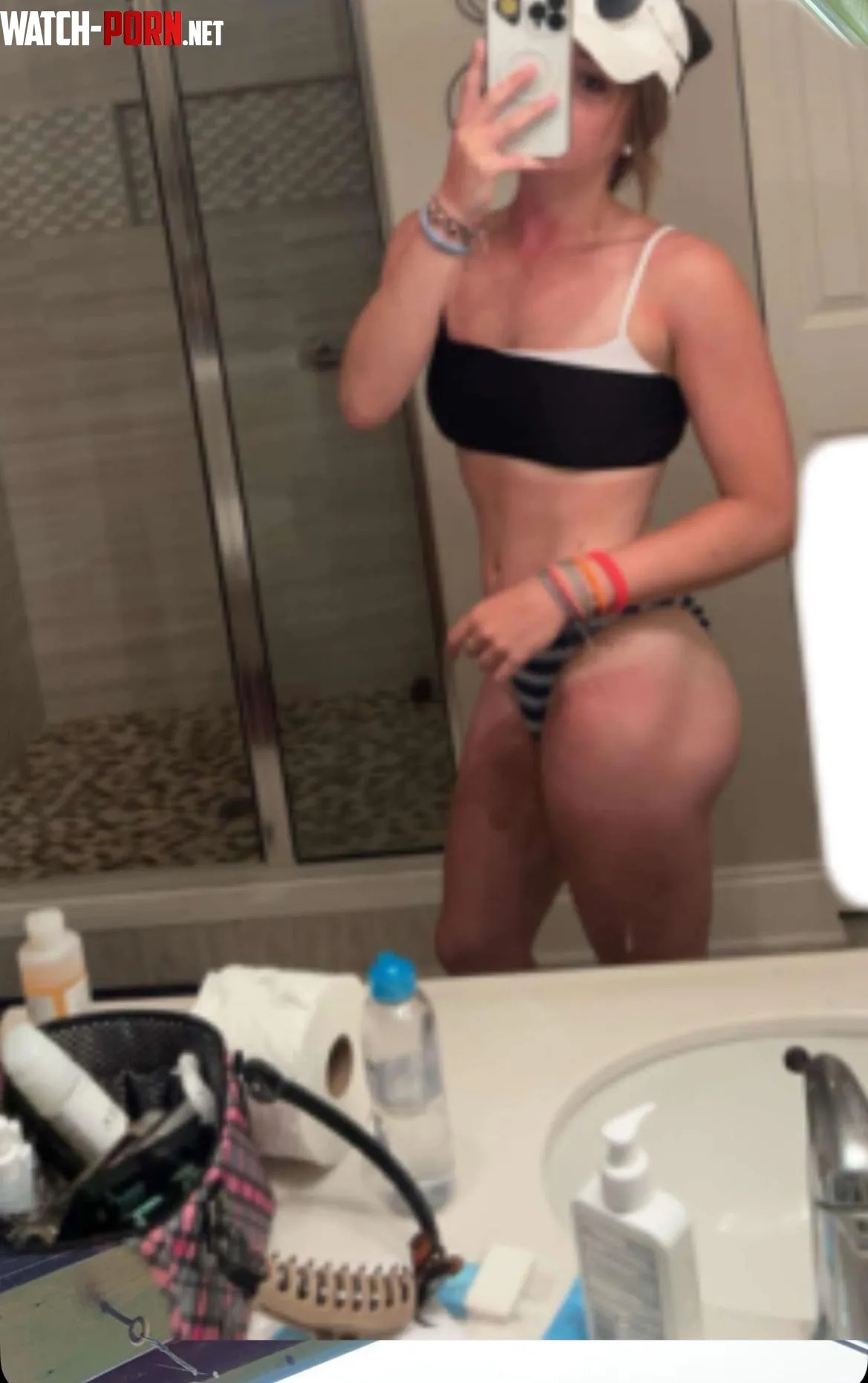 Got a little burnt today by Routine_Sweet2081