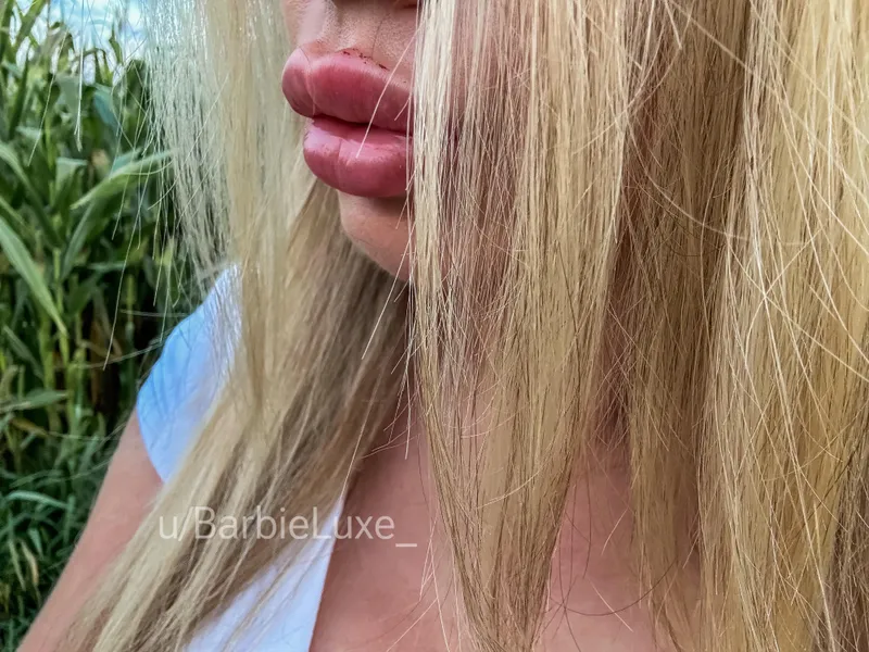 Thumbnail fresh filled lips