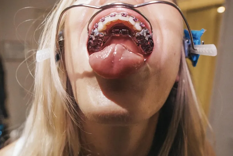 Thumbnail I guess you could call this a mouth bondage fetish