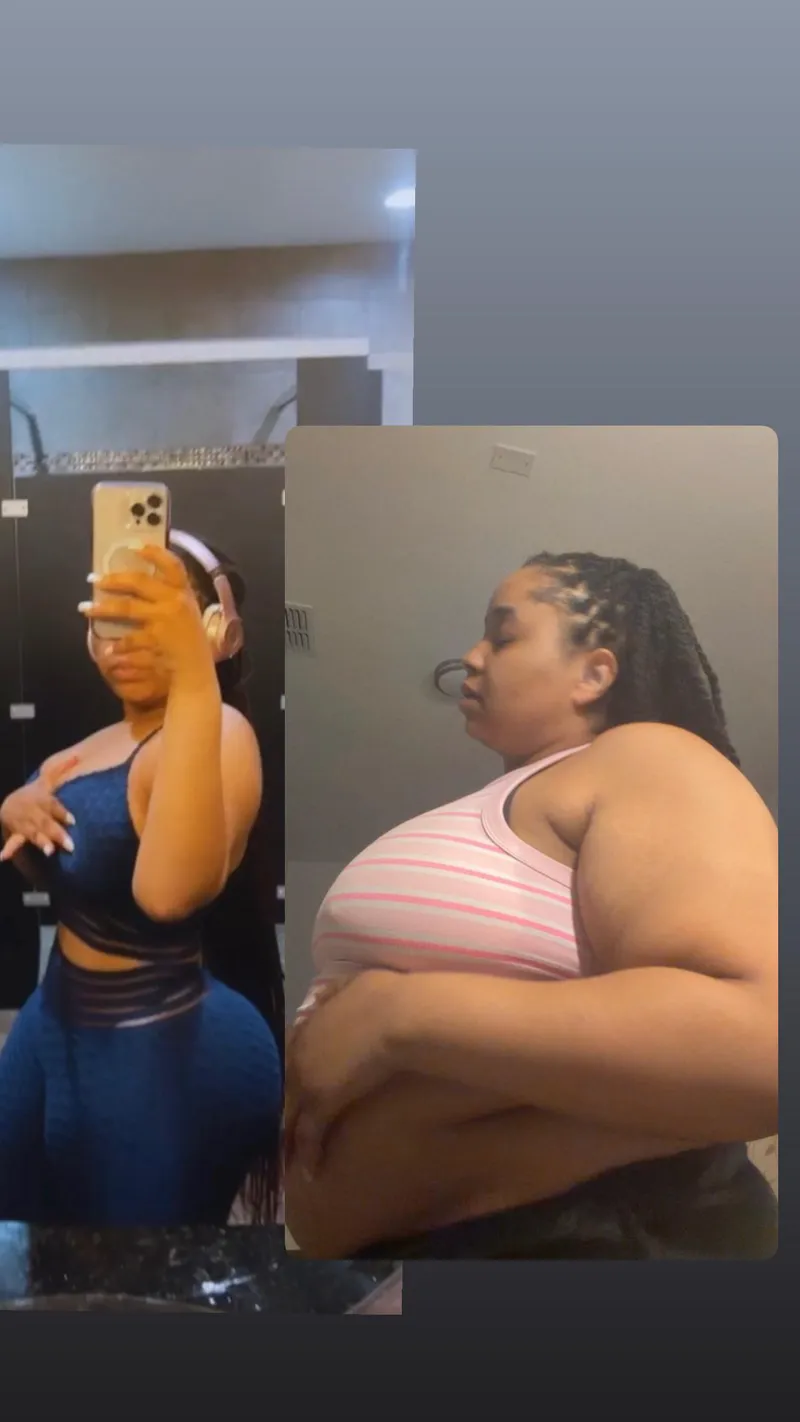 Thumbnail Stripper gains 140 pounds in a year and a half
