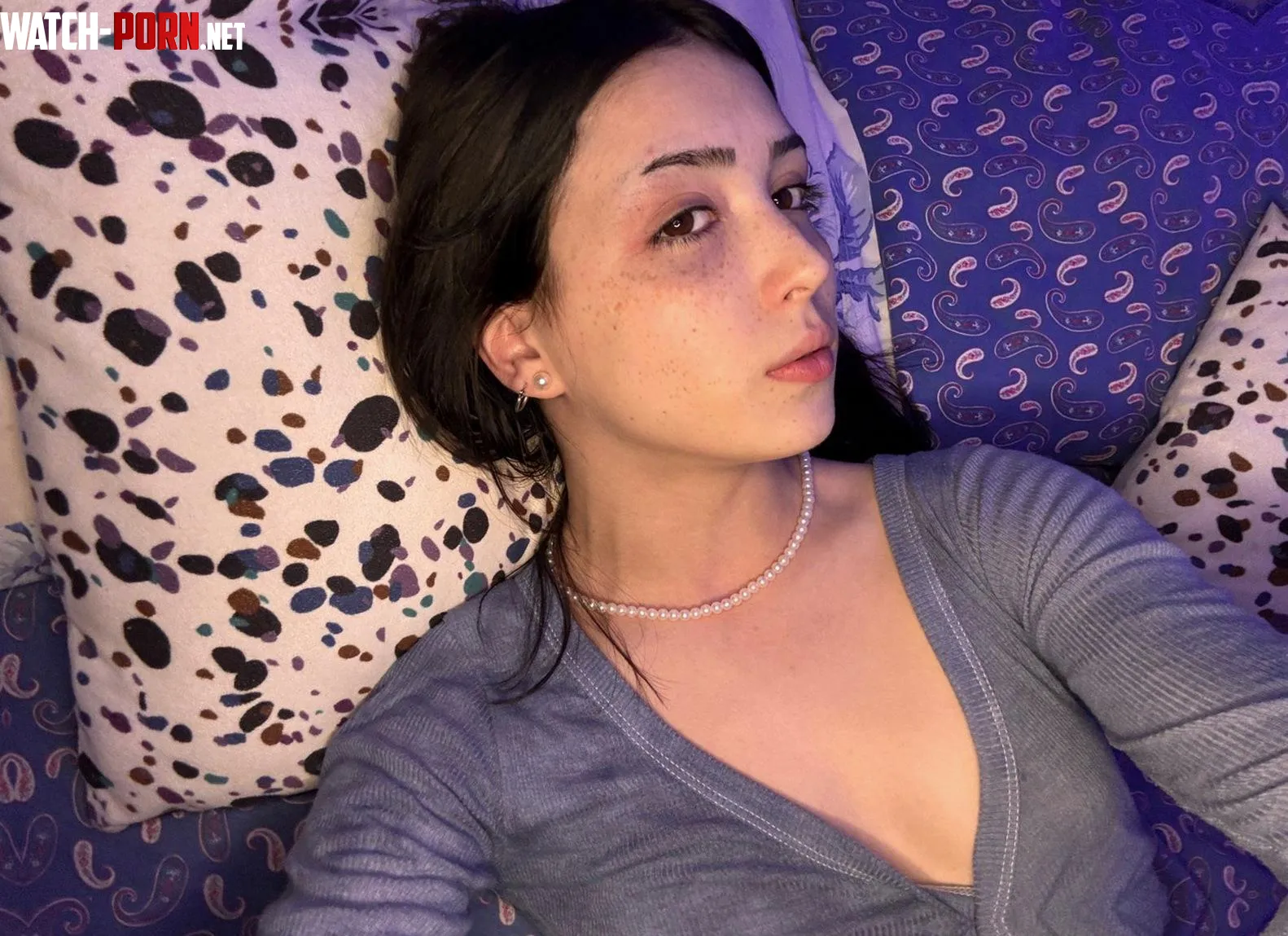 Crop top shows my arm marks by Religious_Spider