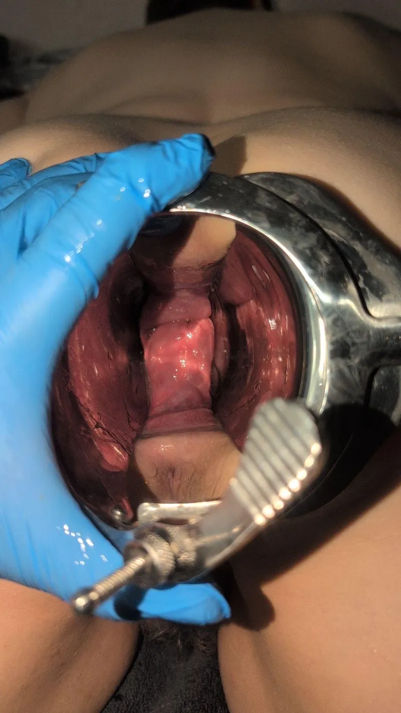 Thumbnail Wide Open Wednesday