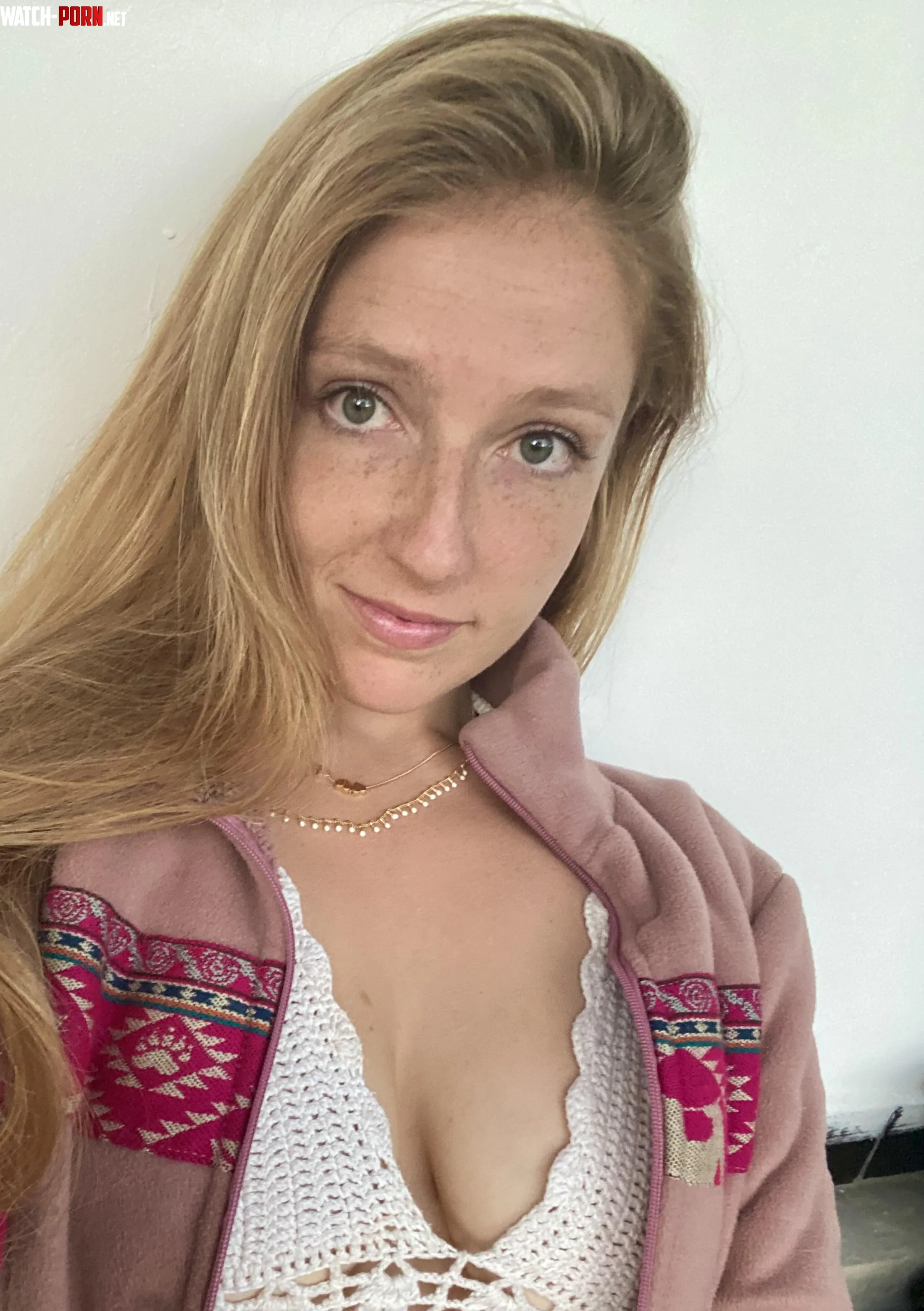 freckles have started blending together by freedom_fruit