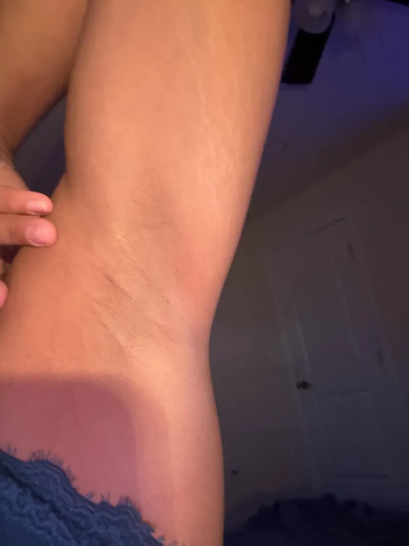 Thumbnail Armpits drive you crazy don’t they