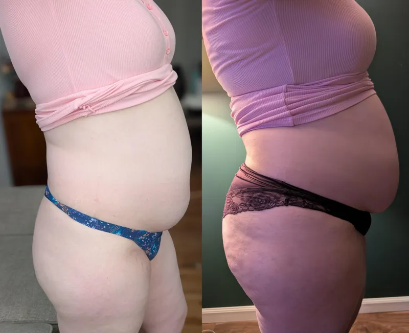 Thumbnail I love making before and afters 😍
