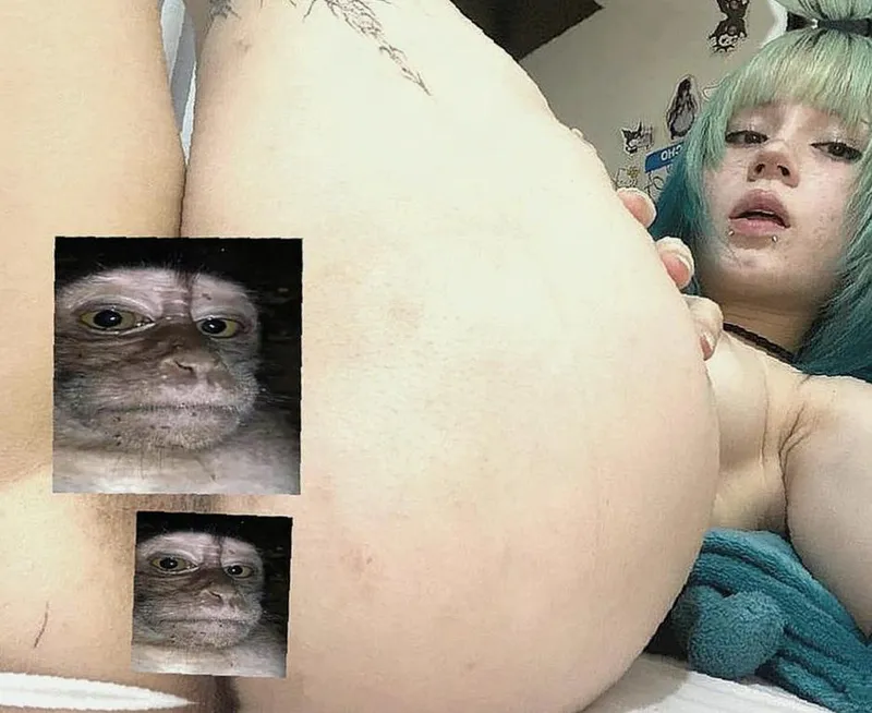 Thumbnail wedgie pulls on my skin