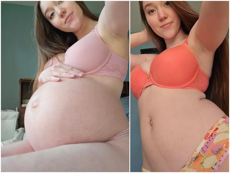 Thumbnail Pregnant belly vs mombod