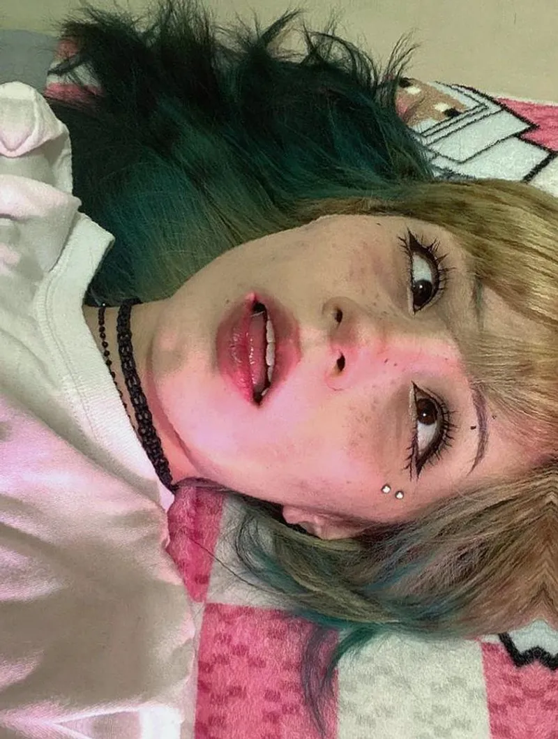 Thumbnail Crop top hides scars