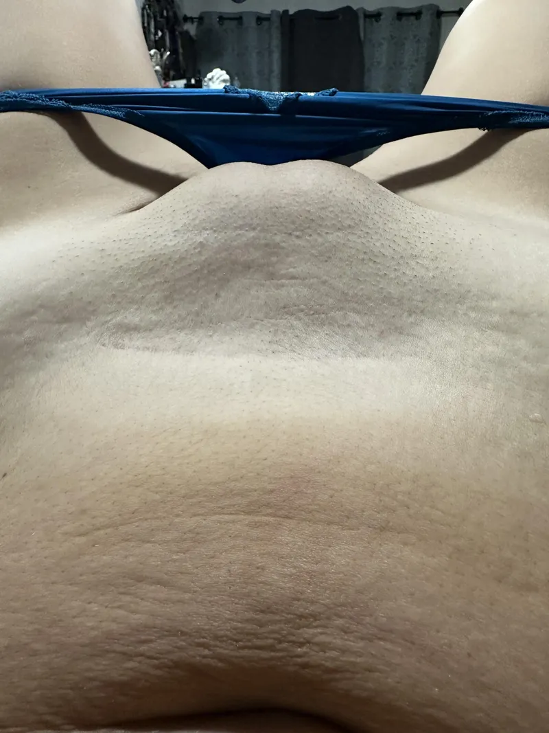 Thumbnail NSFW