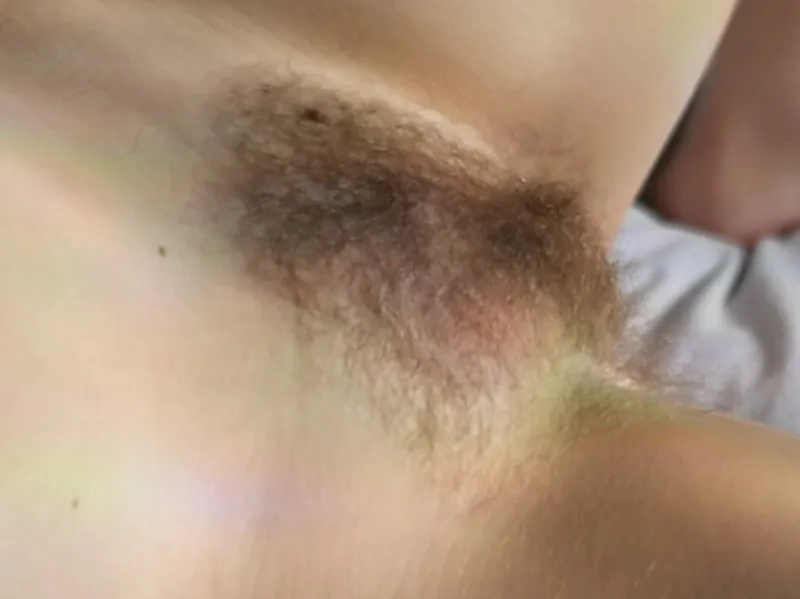 Thumbnail spot my birthmark…