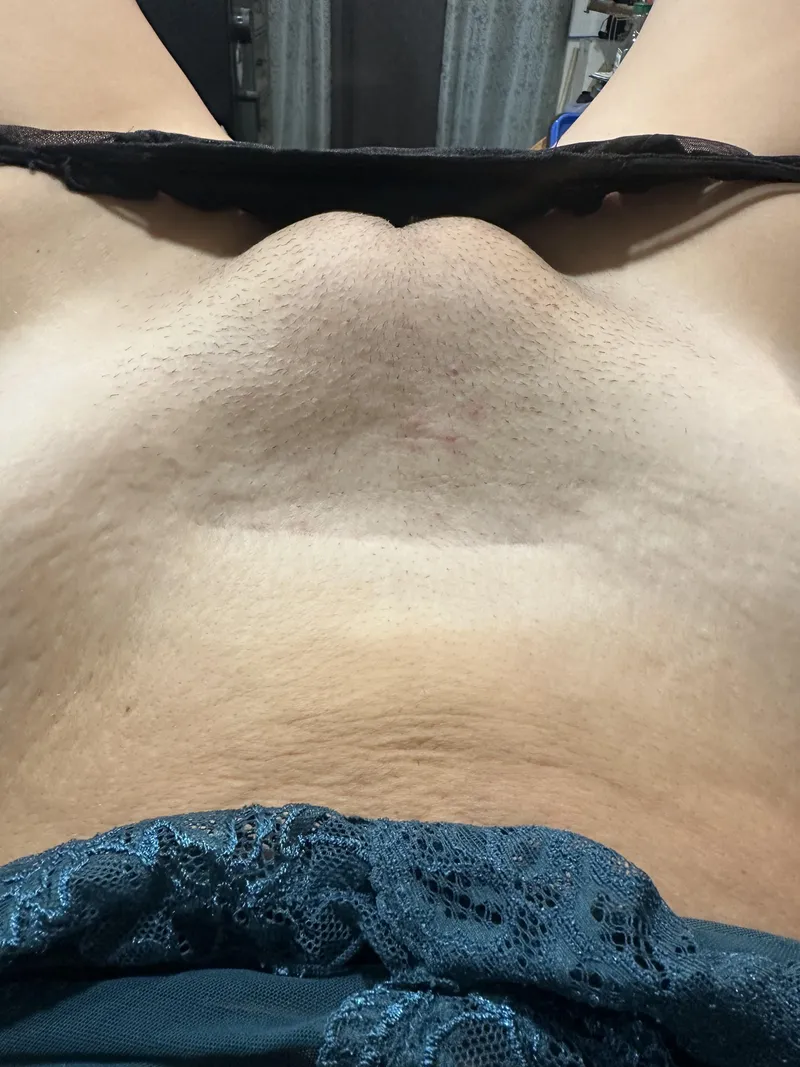 Thumbnail NSFW