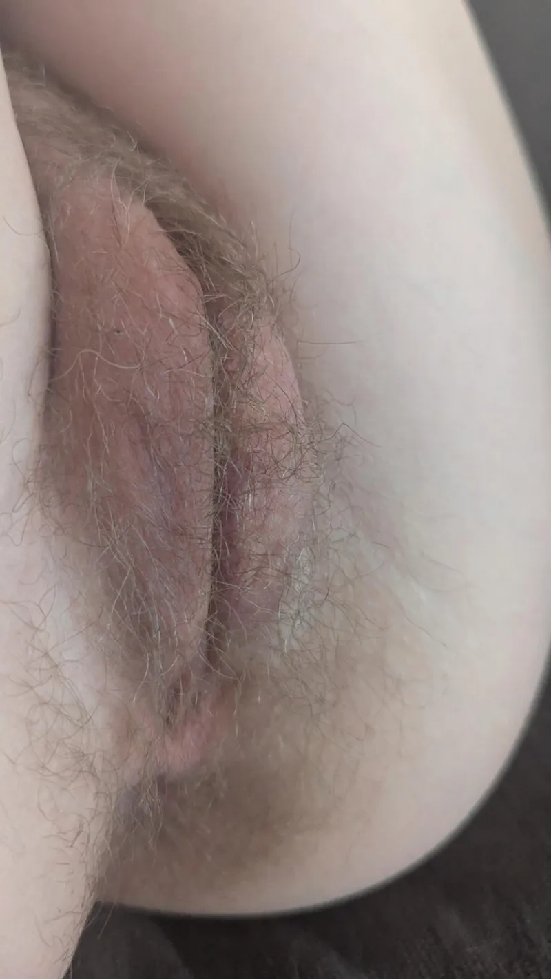 Thumbnail Close-up growing back after a wax~