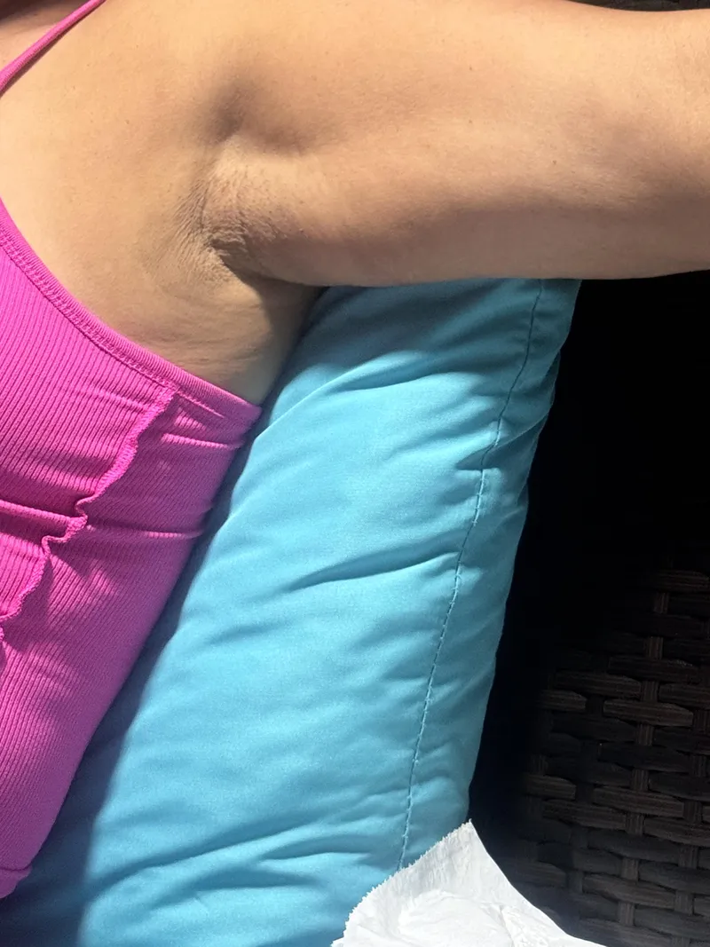 Thumbnail Armpit