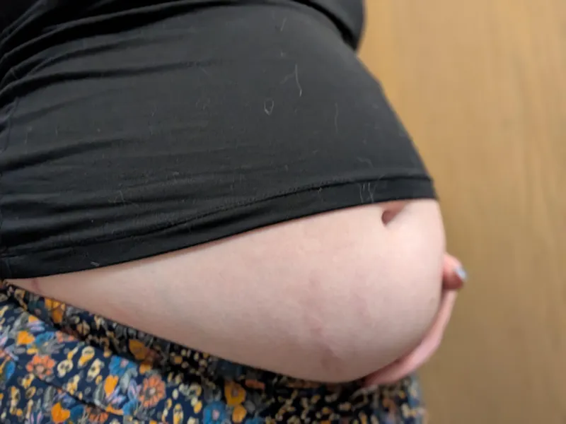Thumbnail Belly ❤️