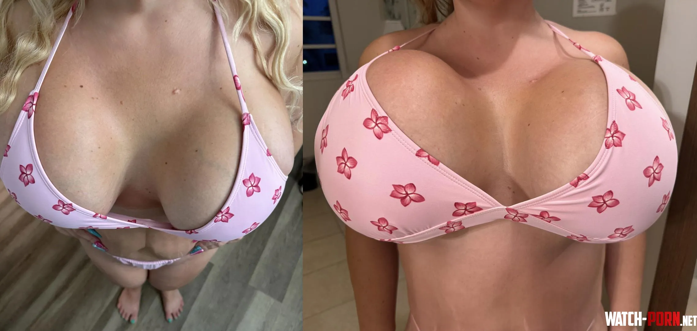 Before and after 2000cc to 2500cc by BimboBabyBianca