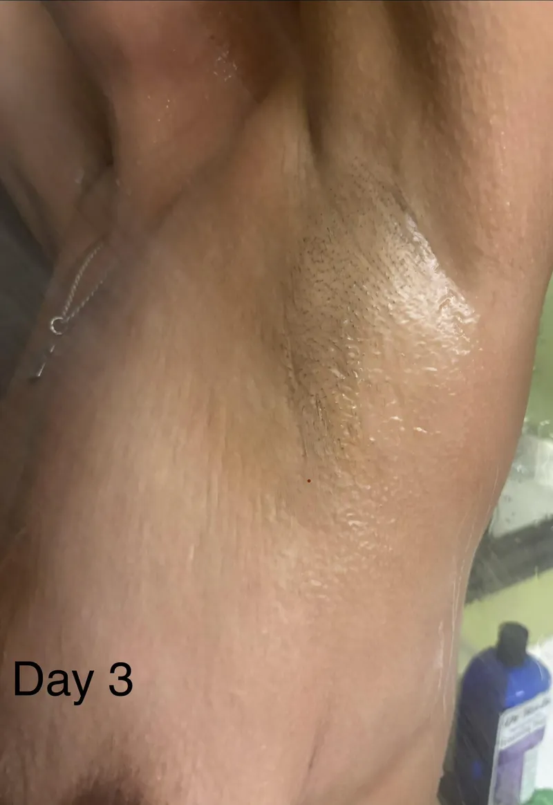 Thumbnail Shave or no shave -day 3