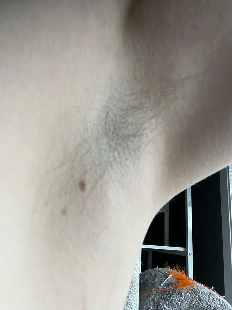 Thumbnail Some of us don’t have much hair…. 44F