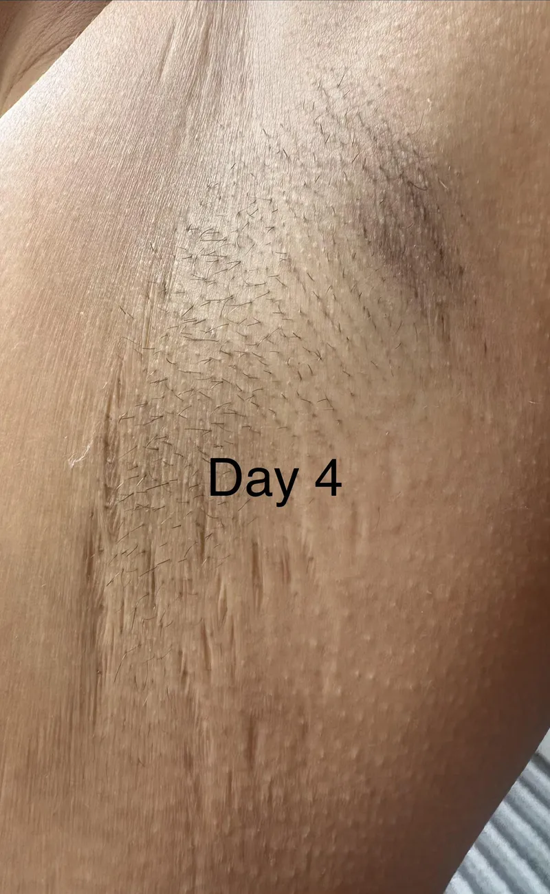 Thumbnail Day 4 no shave no deodorant
