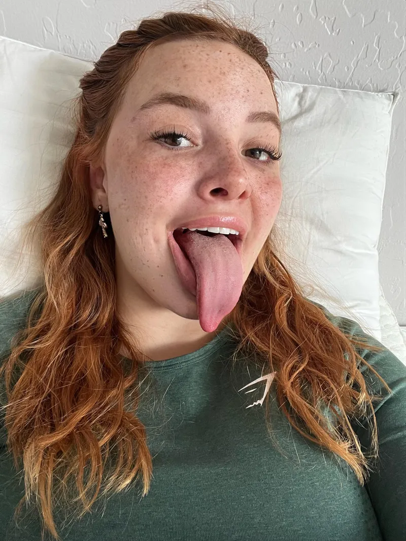 Thumbnail can you count how many freckles i have