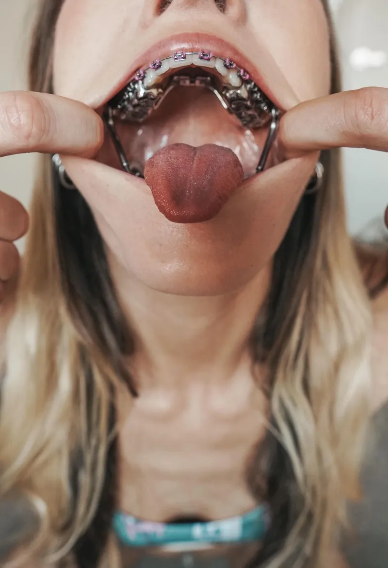 Thumbnail You wouldn’t even know if I had my mouth closed