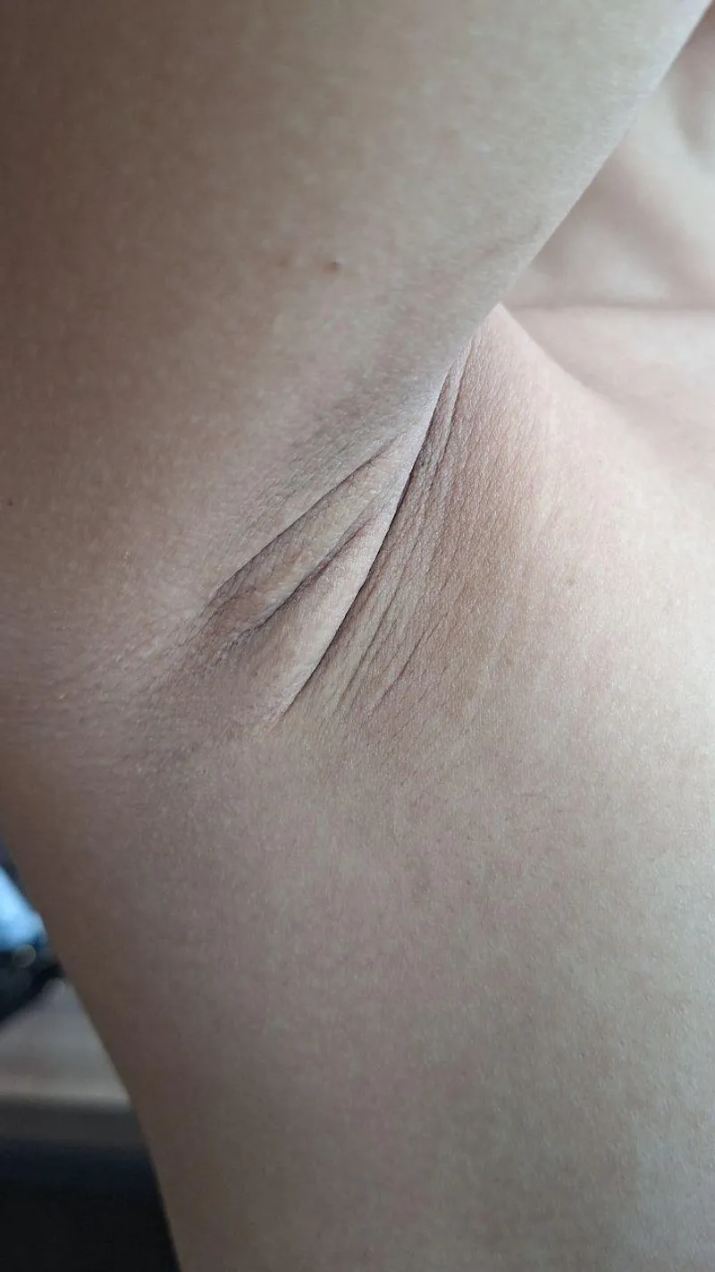 Thumbnail Anyone here into armpit folds? 🤭🤭🤭