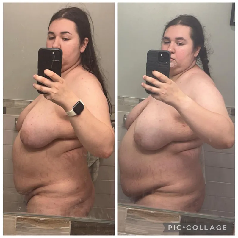Thumbnail Before and after antipsychotics… DMs open