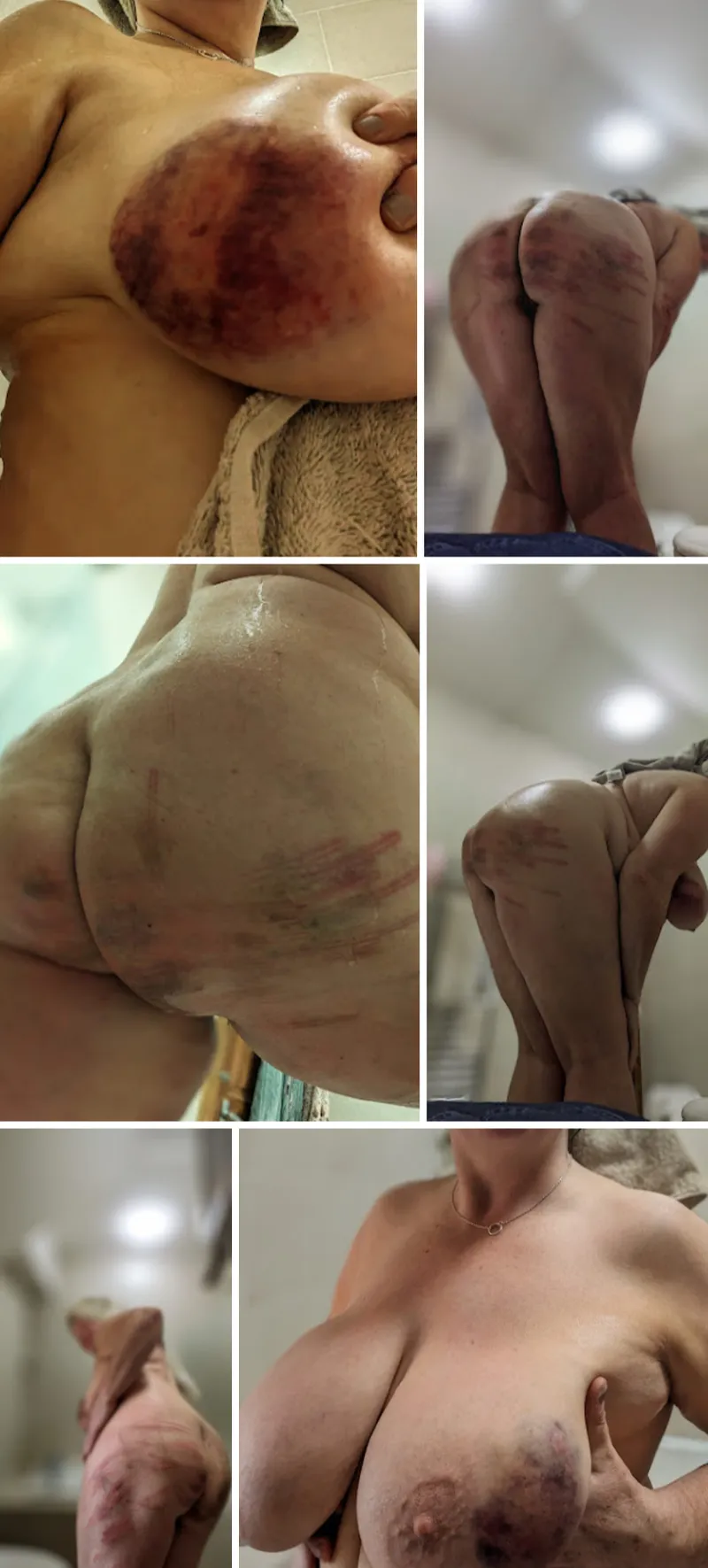 Thumbnail Impact marks from my service to Him [F] the cane, wooden spoon and paddle