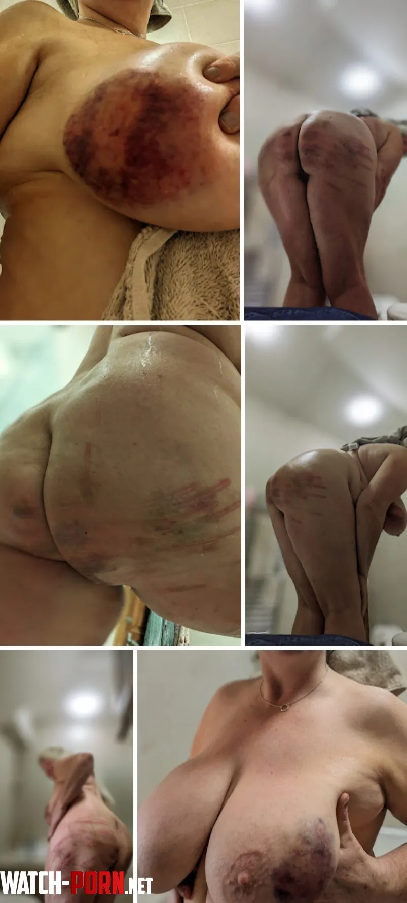 Impact marks from my service to Him [F] the cane, wooden spoon and paddle by jubilee_jubes