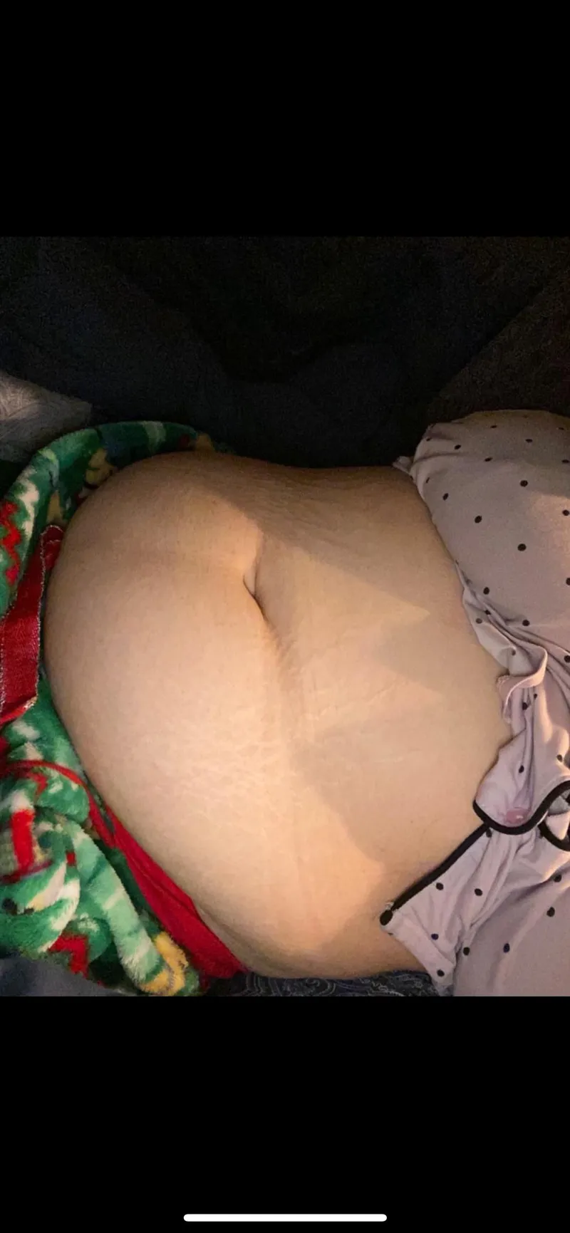 Thumbnail Bloated before bed by Sea-Explanation-4604