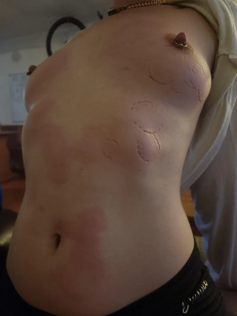 Thumbnail [F]CHOMP!!!!!