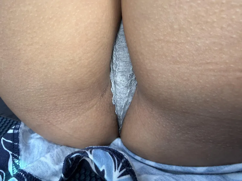 Thumbnail View from under the skirt today by PrestigiousFuel8912