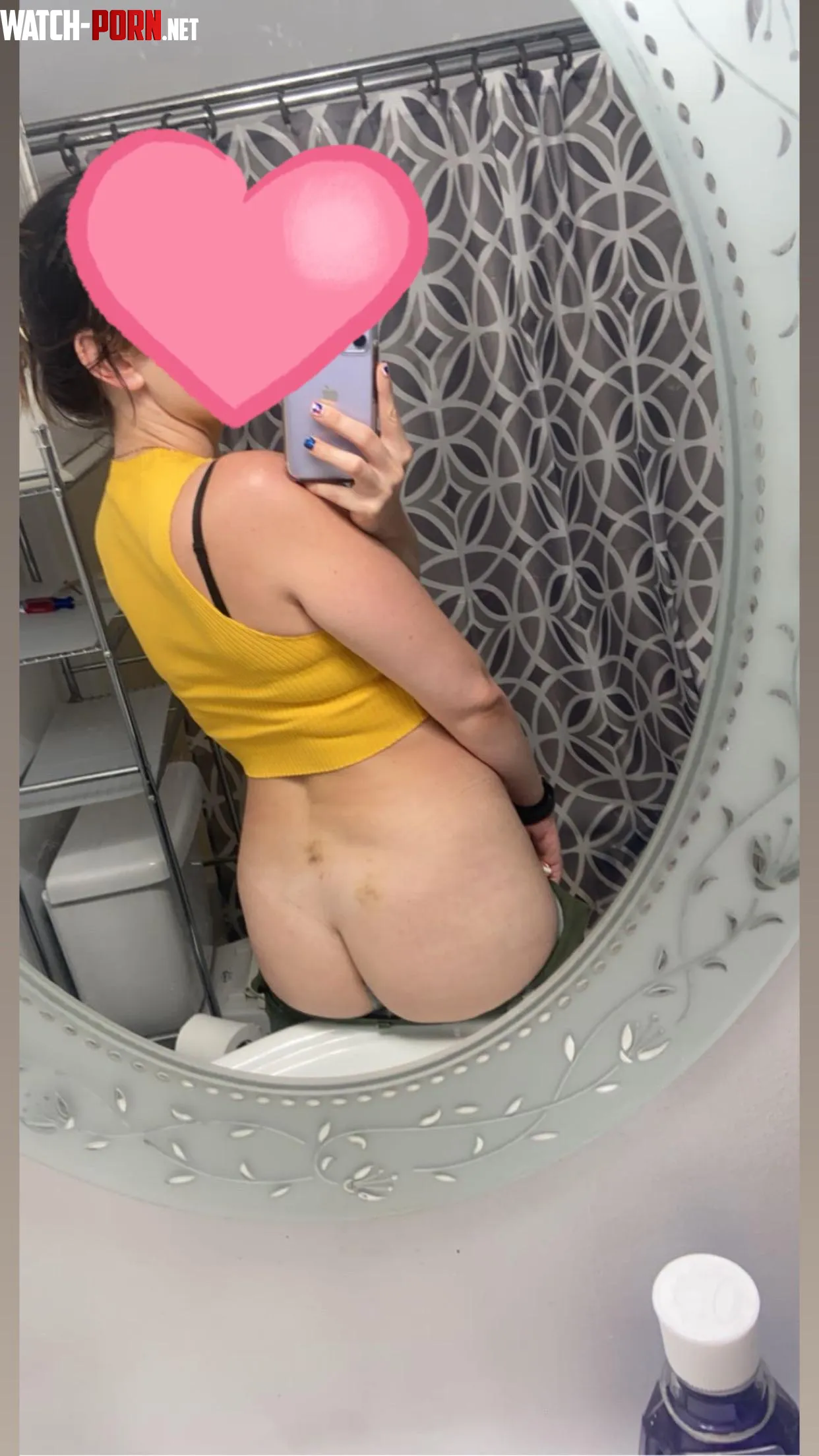 Bruises on my ass are healing nicely after last weekend’s fun 😛 by UFO_plant_